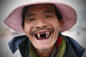 Image result for cười hở 10 cái răng
